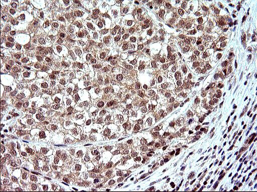 m04394 anti necdin ndn mouse monoclonal antibody clone id oti5d1 ihc testing 17