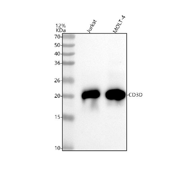Figure 1. Western blot analysis of CD3D using anti-CD3D antibody (M04405). Electrophoresis was performed on a 5-20% SDS-PAGE gel at 70V (Stacking gel) / 90V (Resolving gel) for 2-3 hours. The sample well of each lane was loaded with 30 ug of sample under reducing conditions. Lane 1: human Jurkat whole cell lysates, Lane 2: human MOLT-4 whole cell lysates. After electrophoresis, proteins were transferred to a nitrocellulose membrane at 150 mA for 50-90 minutes. Blocked the membrane with 5% non-fat milk/TBS for 1.5 hour at RT. The membrane was incubated with rabbit anti-CD3D antigen affinity purified monoclonal antibody (Catalog # M04405) at 1:1000 overnight at 4°C, then washed with TBS-0.1%Tween 3 times with 5 minutes each and probed with a goat anti-rabbit IgG-HRP secondary antibody at a dilution of 1:500 for 1.5 hour at RT. The signal is developed using an Enhanced Chemiluminescent detection (ECL) kit (Catalog # EK1002) with Tanon 5200 system. A specific band was detected for CD3D at approximately 21 kDa. The expected band size for CD3D is at 19 kDa.