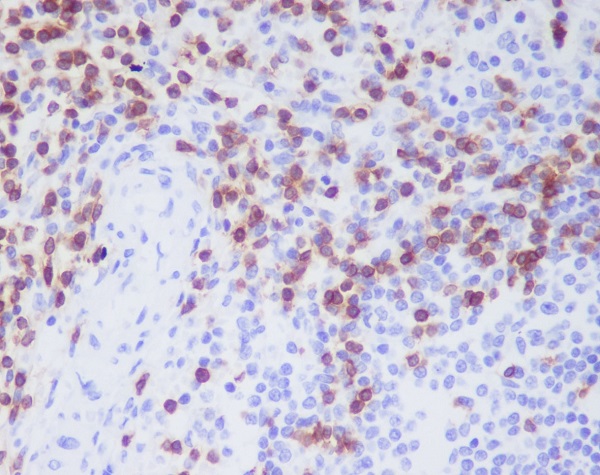 Immunohistochemical analysis of paraffin-embedded human spleen, using CD3D Antibody.