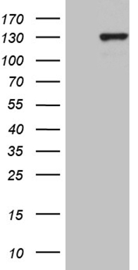 HEK293T cells were transfected with the pCMV6-ENTRY control (Left lane) or pCMV6-ENTRY PMS1 (Right lane) cDNA for 48 hrs and lysed