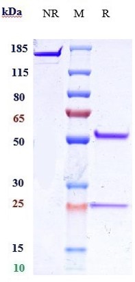 Anti-IL-25 Reference Antibody (Centocor patent anti-IL-25) on SDS-PAGE under reducing (R) condition