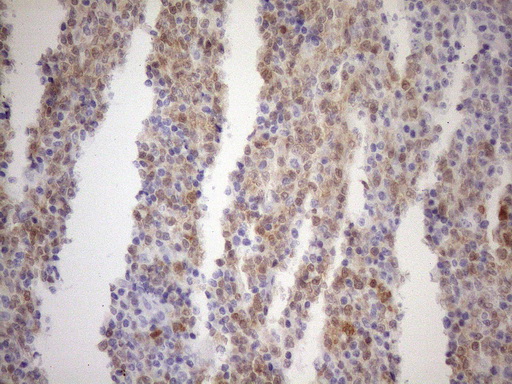 m04431 2 anti bob1 pou2af1 mouse monoclonal antibody clone id oti2d3 ihc testing 2