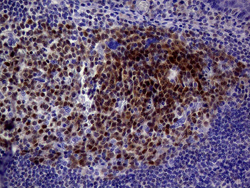m04431 2 anti bob1 pou2af1 mouse monoclonal antibody clone id oti2d3 ihc testing 3