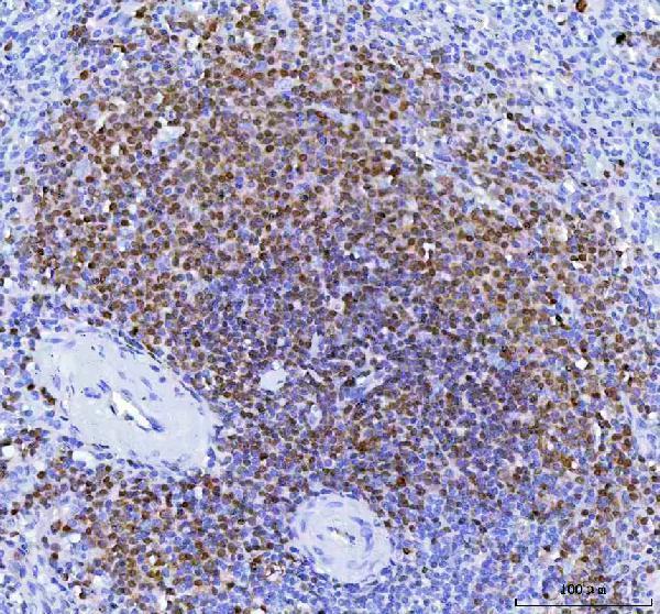  IHC analysis of POU2AF1 using anti-POU2AF1 antibody (M04431)