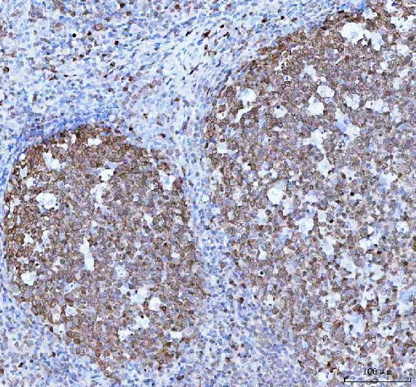 m04431 pou2af1 primary antibodies ihc testing 4
