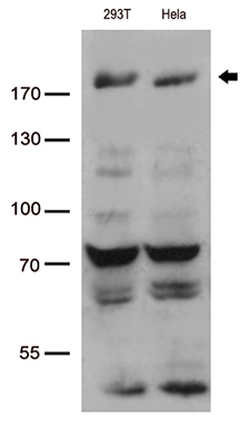 m04438 anti wstf baz1b mouse monoclonal antibody clone id oti3b8 wb testing 1