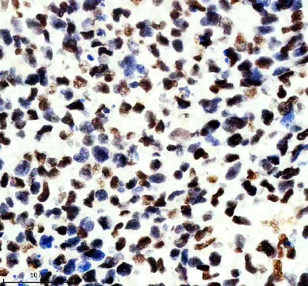 m04443 1 ilf2 primary antibodies ihc testing 1