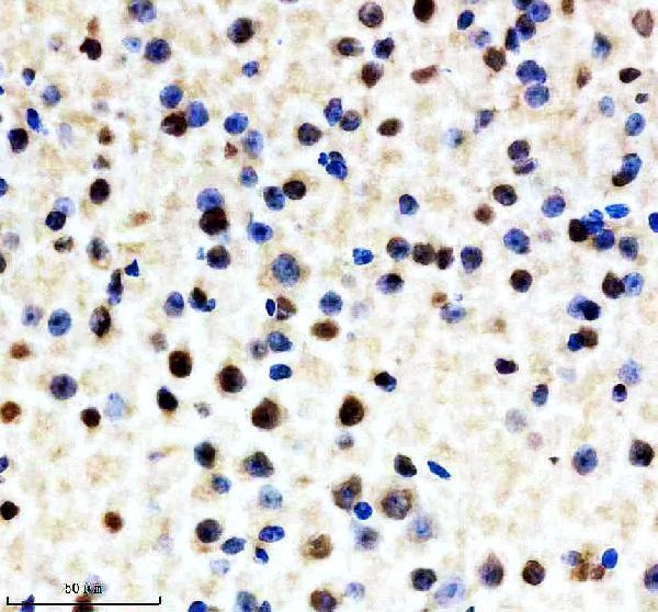 m04443 1 ilf2 primary antibodies ihc testing 10