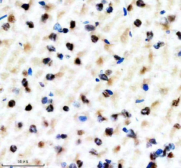 m04443 1 ilf2 primary antibodies ihc testing 11