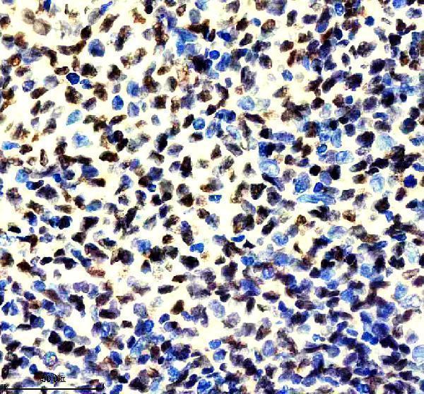 m04443 1 ilf2 primary antibodies ihc testing 2