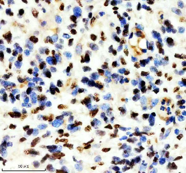 m04443 1 ilf2 primary antibodies ihc testing 3