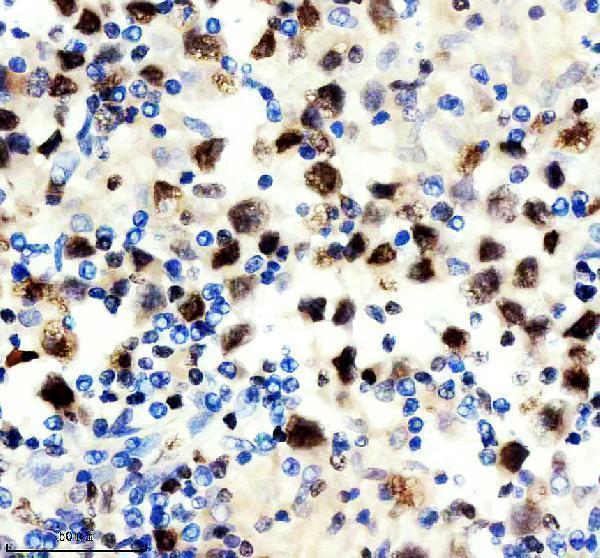 m04443 1 ilf2 primary antibodies ihc testing 4