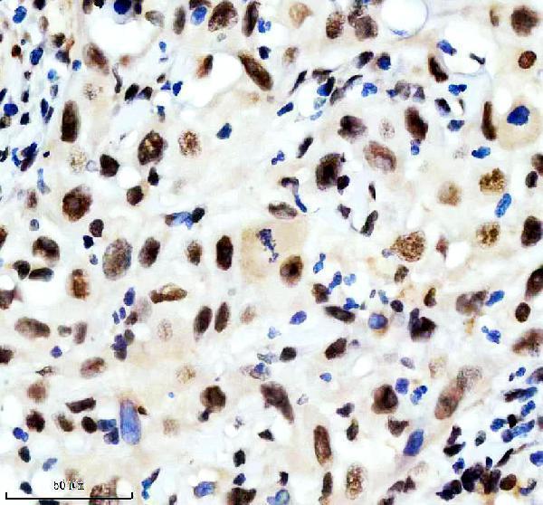 m04443 1 ilf2 primary antibodies ihc testing 5
