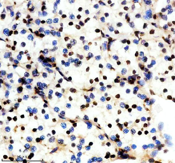 m04443 1 ilf2 primary antibodies ihc testing 6