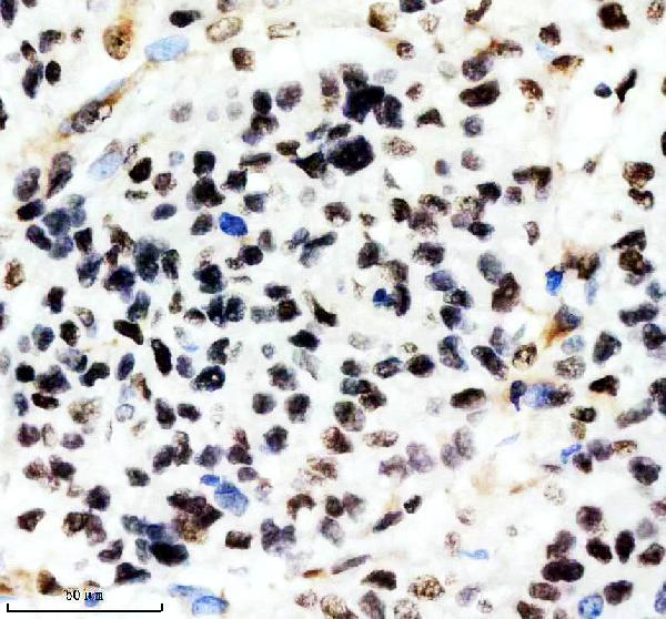 m04443 1 ilf2 primary antibodies ihc testing 7