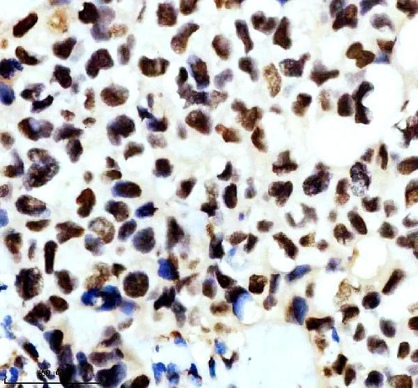 m04443 1 ilf2 primary antibodies ihc testing 8