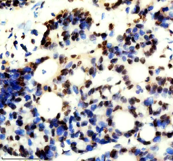 m04443 1 ilf2 primary antibodies ihc testing 9