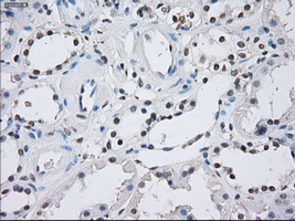 Immunohistochemical staining of paraffin-embedded Kidney tissue within the normal limits using anti-ILF2mouse monoclonal antibody
