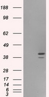 HEK293T cells were transfected with the pCMV6-ENTRY control (Left lane) or pCMV6-ENTRY ILF2 (Right lane) cDNA for 48 hrs and lysed