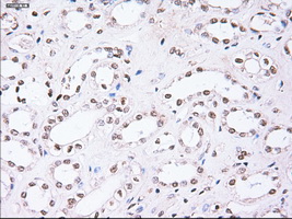 m04448 anti noggin nog mouse monoclonal antibody clone id oti1c1 ihc testing 10