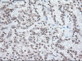 m04448 anti noggin nog mouse monoclonal antibody clone id oti1c1 ihc testing 11