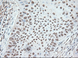 m04448 anti noggin nog mouse monoclonal antibody clone id oti1c1 ihc testing 4