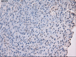 m04448 anti noggin nog mouse monoclonal antibody clone id oti1c1 ihc testing 5