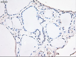 m04448 anti noggin nog mouse monoclonal antibody clone id oti1c1 ihc testing 6
