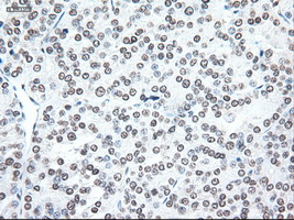 m04448 anti noggin nog mouse monoclonal antibody clone id oti1c1 ihc testing 7