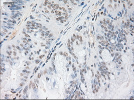 m04448 anti noggin nog mouse monoclonal antibody clone id oti1c1 ihc testing 9