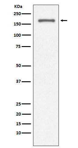 Western blot analysis of CD11a expression in Jurkat cell lysate