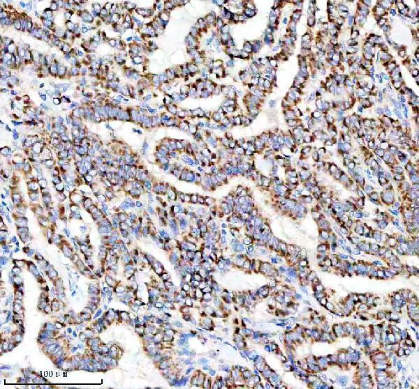 m04469 1 dlat primary antibodies ihc testing 4