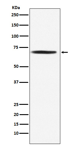 Western blot analysis of DLAT expression in Jurkat cell lysate