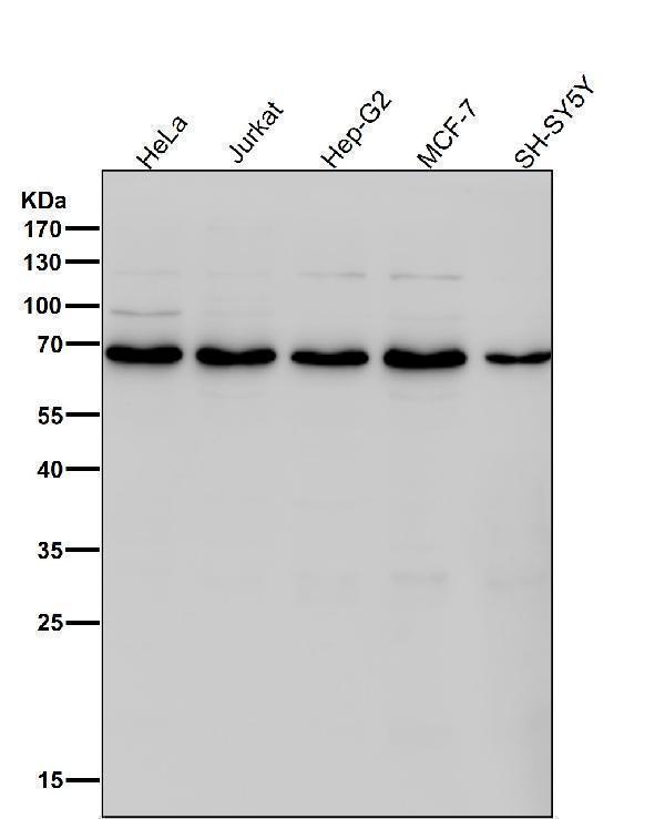 All lanes use the Antibody at 1:1W dilution for 1 hour at room temperature