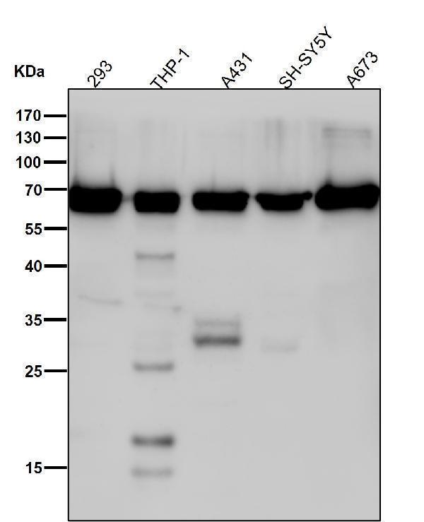 All lanes use the Antibody at 1:1W dilution for 1 hour at room temperature