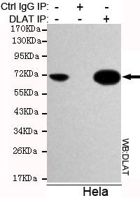 Immunoprecipitation analysis of Hela cell lysates using DLAT antibody