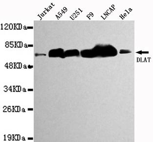 Western blot detection of DLAT in Jurkat, A549, U251, F9, LNCAP&Hela cell lysates using DLAT antibody (1:1000 diluted) 