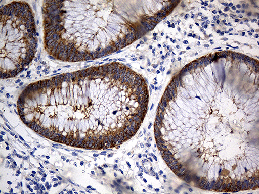 Immunohistochemical staining of paraffin-embedded Human appendix tissue within the normal limits using anti-TRIM29 mouse monoclonal antibody