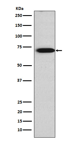 Western blot analysis of TRIM29 expression in JAR cell lysate