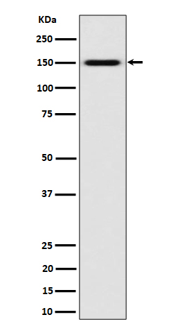 Western blot analysis of SLC12A1 / NKCC2 expression in K562 cell lysate
