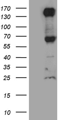 HEK293T cells were transfected with the pCMV6-ENTRY control (Left lane) or pCMV6-ENTRY ROBO4 (Right lane) cDNA for 48 hrs and lysed