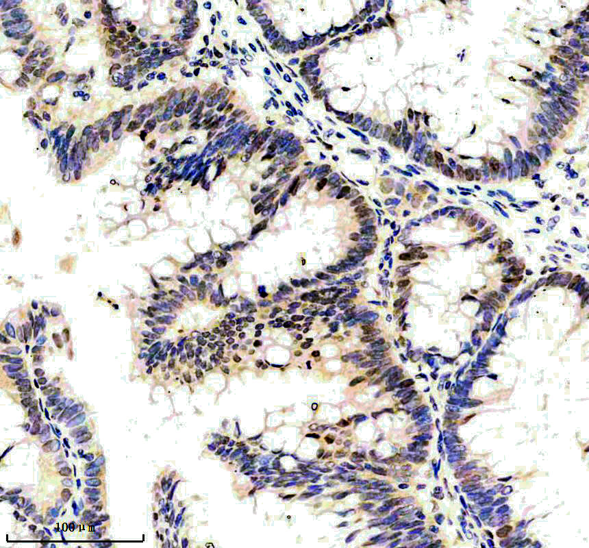 IHC analysis of KIF4A using anti-KIF4A antibody (M04486)