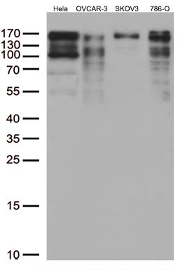 m04488 anti larp1 mouse monoclonal antibody clone id oti4e2 wb testing 2