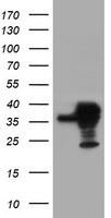 HEK293T cells were transfected with the pCMV6-ENTRY control (Left lane) or pCMV6-ENTRY SERPINB1 (Right lane) cDNA for 48 hrs and lysed