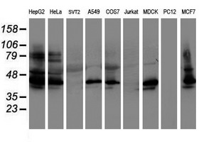 Western blot analysis of extracts (35ug) from 9 different cell lines by using anti-SERPINB1 monoclonal antibody (HepG2: human; HeLa: human; SVT2: mouse; A549: human; COS7: monkey; Jurkat: human; MDCK: canine; PC12: rat; MCF7: human)