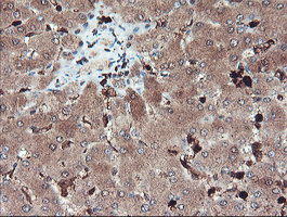 m04491 anti serpinb1 mouse monoclonal antibody clone id oti4b3 ihc testing 10