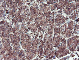 m04491 anti serpinb1 mouse monoclonal antibody clone id oti4b3 ihc testing 11