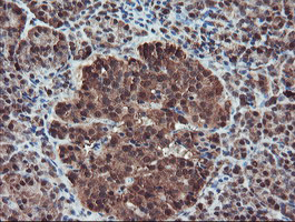 m04491 anti serpinb1 mouse monoclonal antibody clone id oti4b3 ihc testing 4