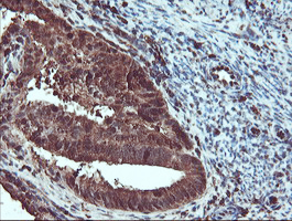 m04491 anti serpinb1 mouse monoclonal antibody clone id oti4b3 ihc testing 6