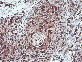 m04491 anti serpinb1 mouse monoclonal antibody clone id oti4b3 ihc testing 7